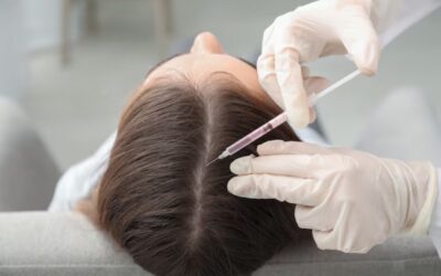 ประเภทของวิกสำหรับคนผมบาง